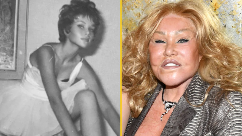 2. Jocelyn Wildenstein 